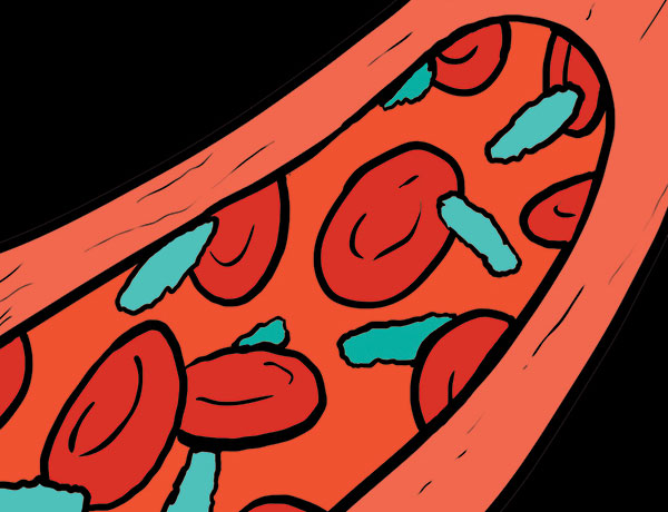 Researchers find potential new weapon for battling sepsis