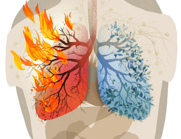 How long before long COVID is extinguished?